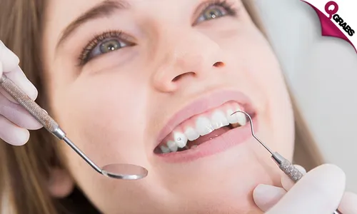 Teeth Scaling, Polishing, Filling & Jewel!